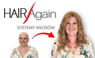 niechirurgiczny przeszczep włosów niechirurgiczny przeszczep włosów